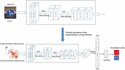 Diagnostic model optimization method for ADHD based on brain network analysis of resting-state fMRI images and transfer learning neural network